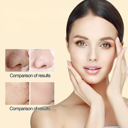 FreshGlow™ Deep Clean Exfoliating Gel